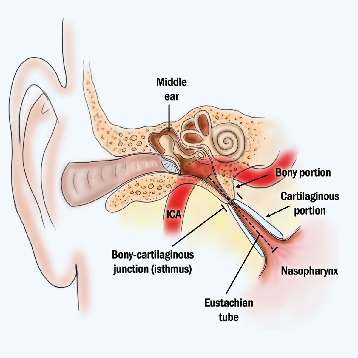 hearing loss treatment 1